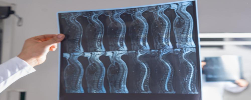 Denver spine injury attorney